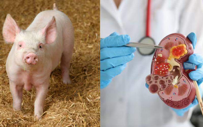 मनुष्य में सुअर का गुर्दा प्रतिरोपित किए जाने संबंधी पहला नैदानिक परीक्षण किया गया